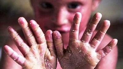 میان کمکمعیشت ناچیز و قطعی برق؛ فریاد معلولان از بحران معیشت و خدمات