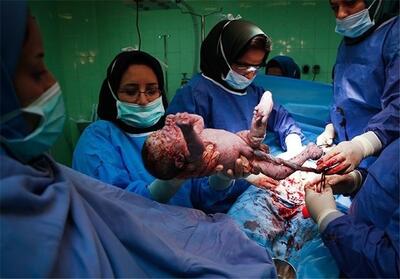  هشدار درباره سزارین‌های انتخابی در شیراز؛ خطر برای سلامت مادر و نوزاد - تسنیم