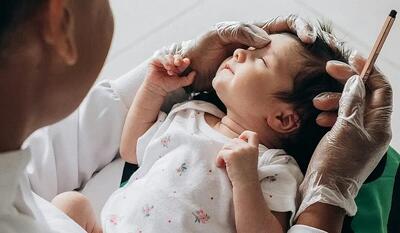 حجامت گوش نوزادان برای درمان زردی موثر است؟