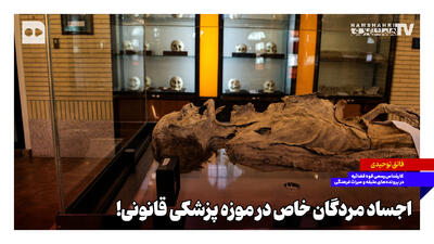  اجساد مردگان خاص در موزه پزشکی قانونی