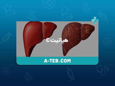  شناسایی ۷۰۷ مبتلای فعال به هپاتیت C در شیراز / ۶۳۵ بیمار وارد چرخه درمان شدند