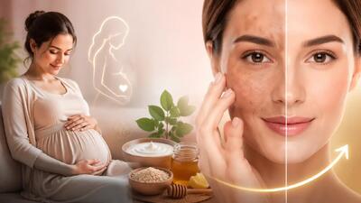 جلوگیری از لک صورت در بارداری + درمان خانگی لک صورت بعد از زایمان