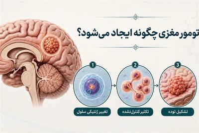 جدیدترین عوامل ایجادکننده تومور مغزی علت تومور مغزی چیست؟ - تسنیم