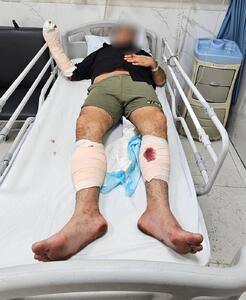  شرور سابقه‌دار عامل ضرب‌وشتم بانوان با شلیک پلیس تهران زمین‌گیر شد