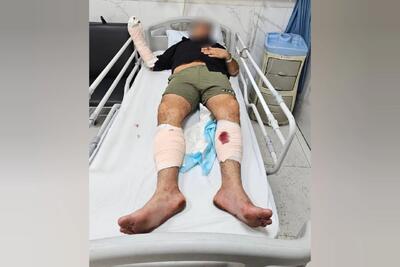 پلیس: عامل ضرب و شتم بانوان در تهران، دستگیر شد/ وی دارای سابقه مزاحمت از طریق فضای مجازی و تهدید به قتل است