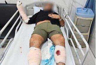  شرور سابقه‌دار با شلیک پلیس زمین‌گیر شد +ویدئو