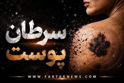  این تغییرات روی پوست را جدی بگیرید؛ شاید نشانه سرطان باشد