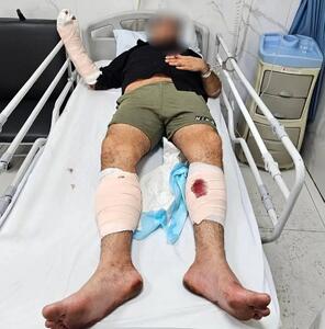  «ضارب دختران» از دو پا و دستی که آنان را کتک می‌زد، گلوله خورد + فیلم عذرخواهی متهم