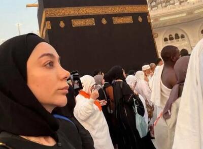 استوری جنجالی شیما کاتوزیان بعد از جایزه نشریه تایم!