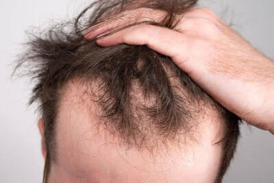 عارضه پنهان مصرف داروهای لاغری