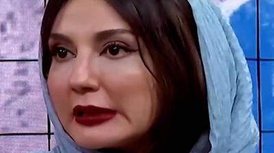  شدت تغییر چهره خانم بازیگر
