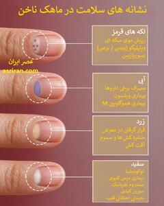این تغییر رنگ در هلال (ماهک) ناخن را نادیده نگیرید! (+اینفوگرافیک)