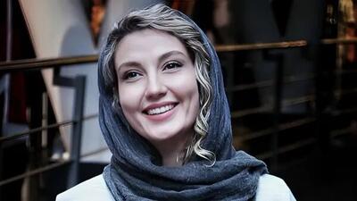عکس | تغییر چهره دور از انتظار و عجیب بازیگر زن ایرانی