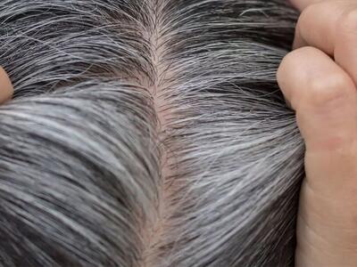 چند راهکار تایید شده برای مقابله با سفیدی مو