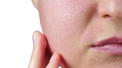 رازهایی که آینه درباره پوست صورت به شما نمیگوید!
