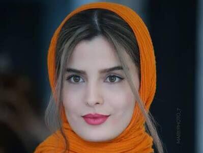  این بازیگر معتقده شبیه نیکول کیدمنه!!!