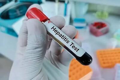 باورهای نادرست درباره هپاتیت+ مؤثرترین راه مقابله