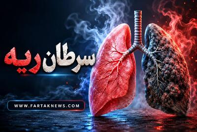 سرفههای مداوم را جدی بگیرید؛ سرطان ریه چه علائمی دارد؟