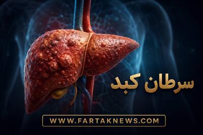  علائم سرطان کبد؛ از درد شکم تا زردی پوست و کاهش وزن