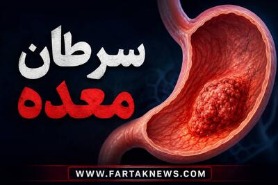 علائم سرطان معده؛ چه زمانی سوءهاضمه میتواند زنگ خطر باشد؟