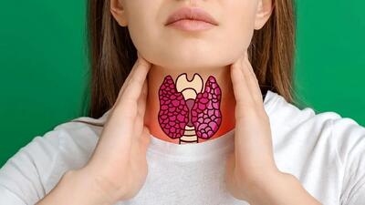 غمباد چیست، چرا زنان بیشتر به بیماری های تیروئید مبتلا میشوند؟