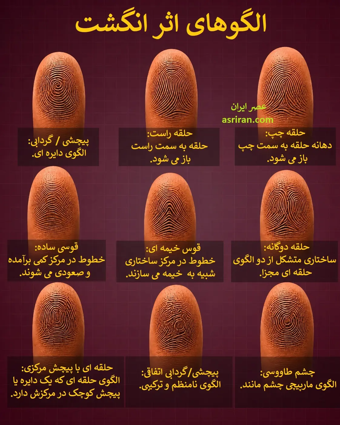 راز خطوط ظریف دست؛ امضای بیولوژیکی که هرگز تغییر نمی کند/ شما کدام الگو را دارید؟ (+اینفوگرافیک)