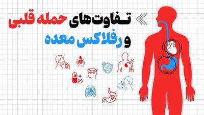 اینفوگرافیک/ تفاوتهای حمله قلبی و رفلاکس معده