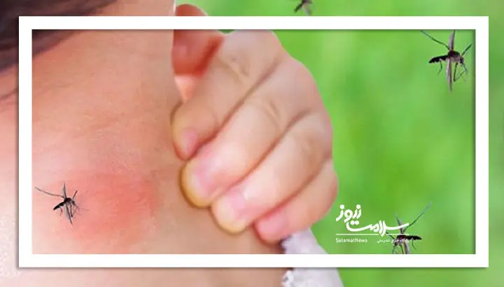راهکاری برای جلوگیری از نیش پشه