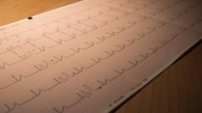 میگنا - از سندرم مرگ ناگهانی بزرگسالان چه میدانید؟