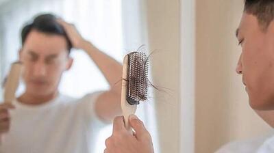  میگنا - پشت پرده ریزش مو در نوجوانان؛ مقصر کیست؟