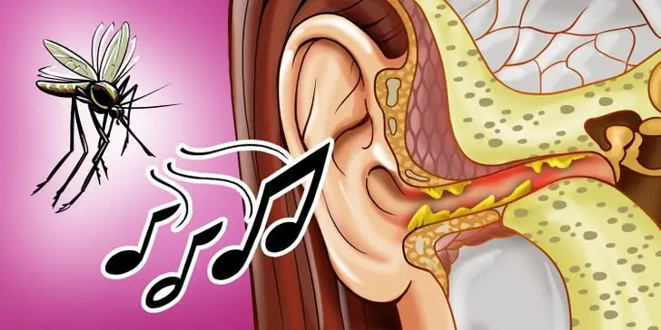 چرا پشهها کنار گوشمان وزوز میکنند؟