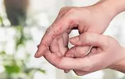 بیماری های خطرناکی که در باشگاه ها وجود دارد!