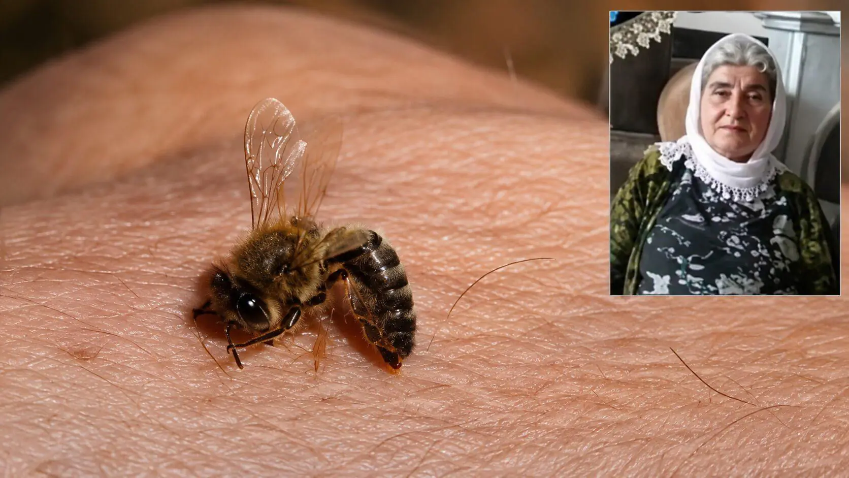 نیش زنبور زن مهابادی را کشت