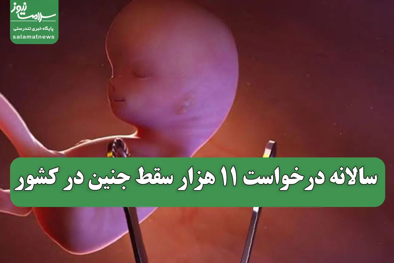 سالانه درخواست 11 هزار سقط جنین در کشور