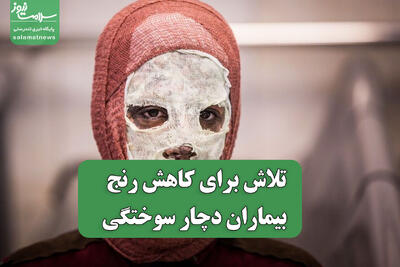  تلاش برای کاهش رنج بیماران دچار سوختگی