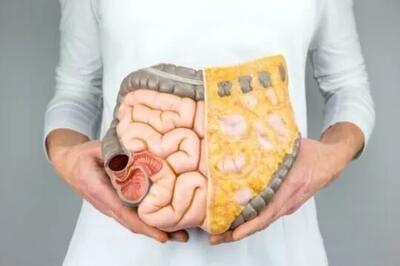 غربالگری سرطان روده بزرگ خطر مرگ را ۴۳ درصد کاهش میدهد