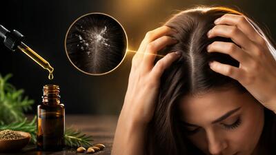  چگونه خارش سر را متوقف کنیم؟ بهترین روغن برای خارش پوست سر