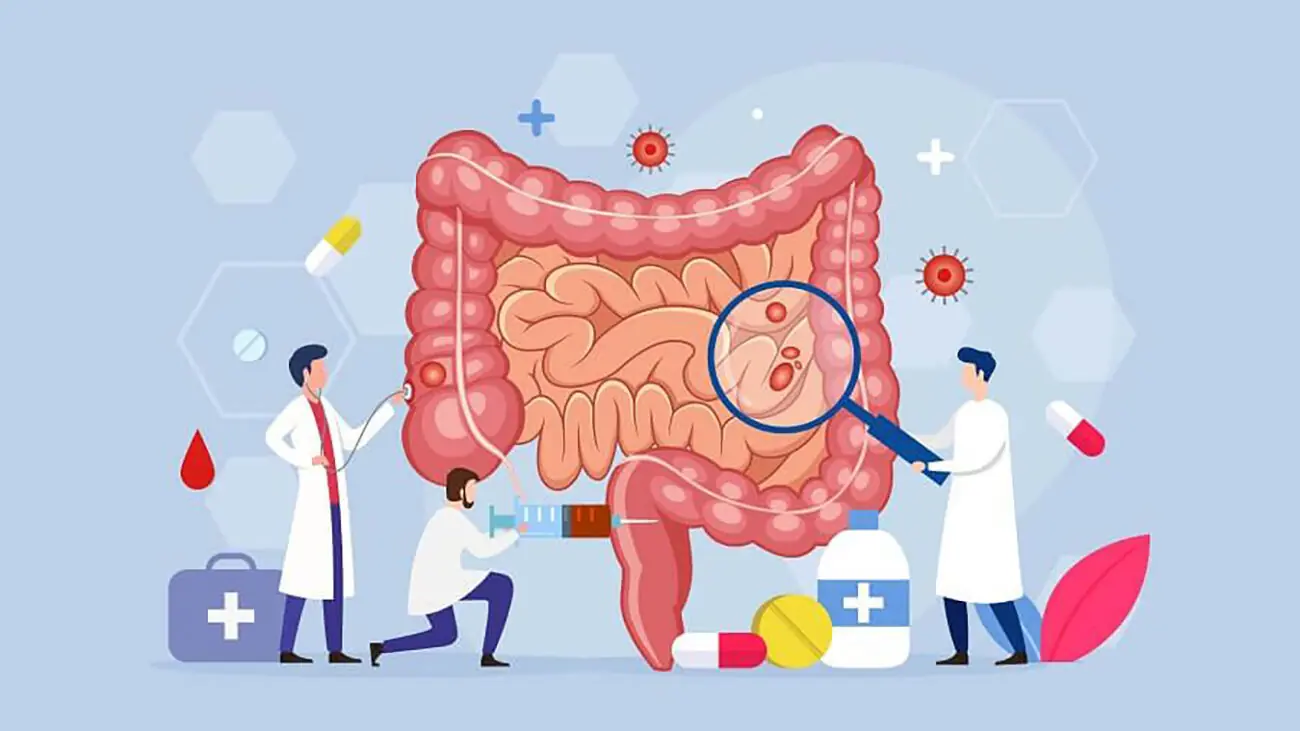 بهترین و بدترین غذاها برای سلامت روده