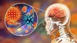 آیا پنیر باعث کند ذهنی میشود؟