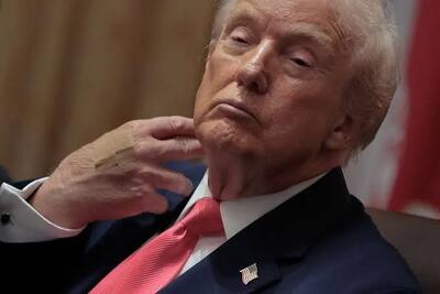 گزارش واشنگتنپست از افزایش مشکلات سلامتی ترامپ