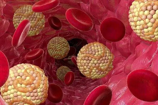 کاهش کلسترول بد؛ راه پیشگیری از سکتههای قلبی و مغزی