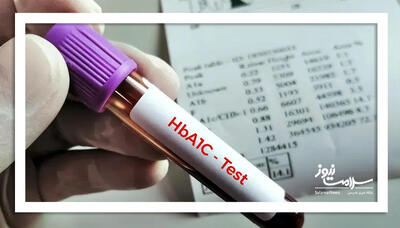 اگر HbA1c شما بالا رفته، این نکات را بدانید