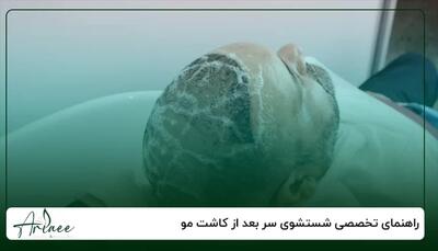 چگونه یک کلینیک معتبر کاشت مو انتخاب کنیم؟ | انصاف نیوز