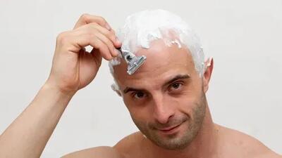  برای از بین بردن شوره سر، سرتان را بتراشید؟ متخصص پوست پاسخ می‌دهد