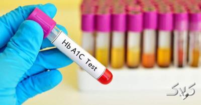  این عدد مهم در آزمایش خون، قند ۳ ماه گذشته‌تان را لو می‌دهد | HbA1c چیست و چرا بالا می‌رود؟ - مجله اینترنتی کولاک