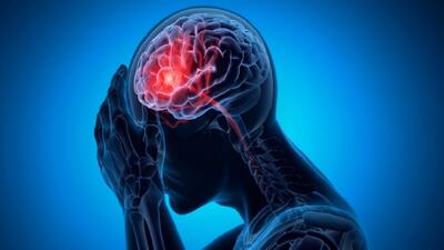 علائم بروز سکته مغزی چیست؟