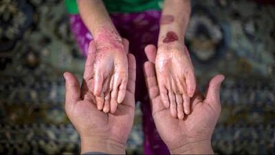 محموله نفت آمریکایی با حکم دادگاه به نفع بیماران پروانهای به فروش رفت