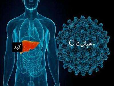  هپاتیت C بیماری خاموش بدون واکسن، اما قابل درمان