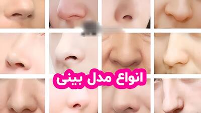  عکس های انواع مدل‌ های بینی  + پاسخ به سوالات متداول درباره عمل بینی