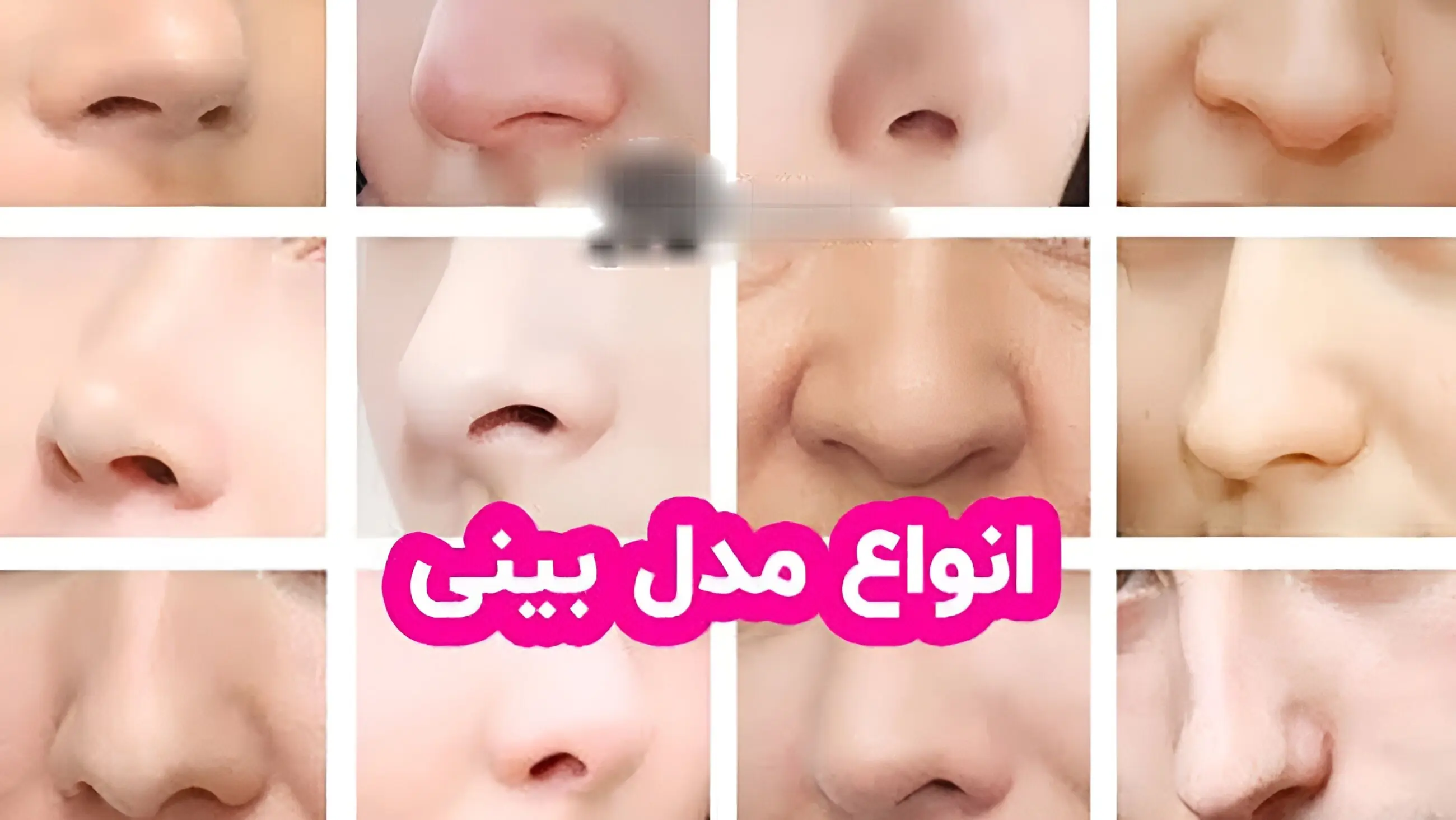  عکس های انواع مدل‌ های بینی  + پاسخ به سوالات متداول درباره عمل بینی
